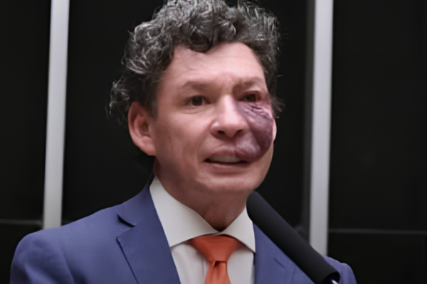 Deputado-do-PT-comandara-fim-da-taxa-das-blusinhas